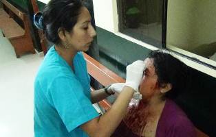 mujer-agredida-por-esposo-2